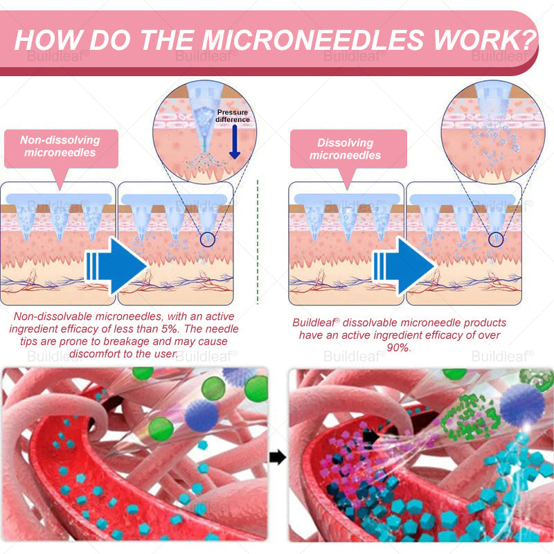 FDA Store | 𝐵uil𝗱𝐿ea𝐟® 𝐆𝐋𝐏-𝟏 Support 𝑁ano 𝑀icroneedle 𝑃atch with Collagen & Matrixyl 3000 丨Obesity,Cardiovascular Diseas, Diabetes, Sleep Apnea, Joint Problems and More