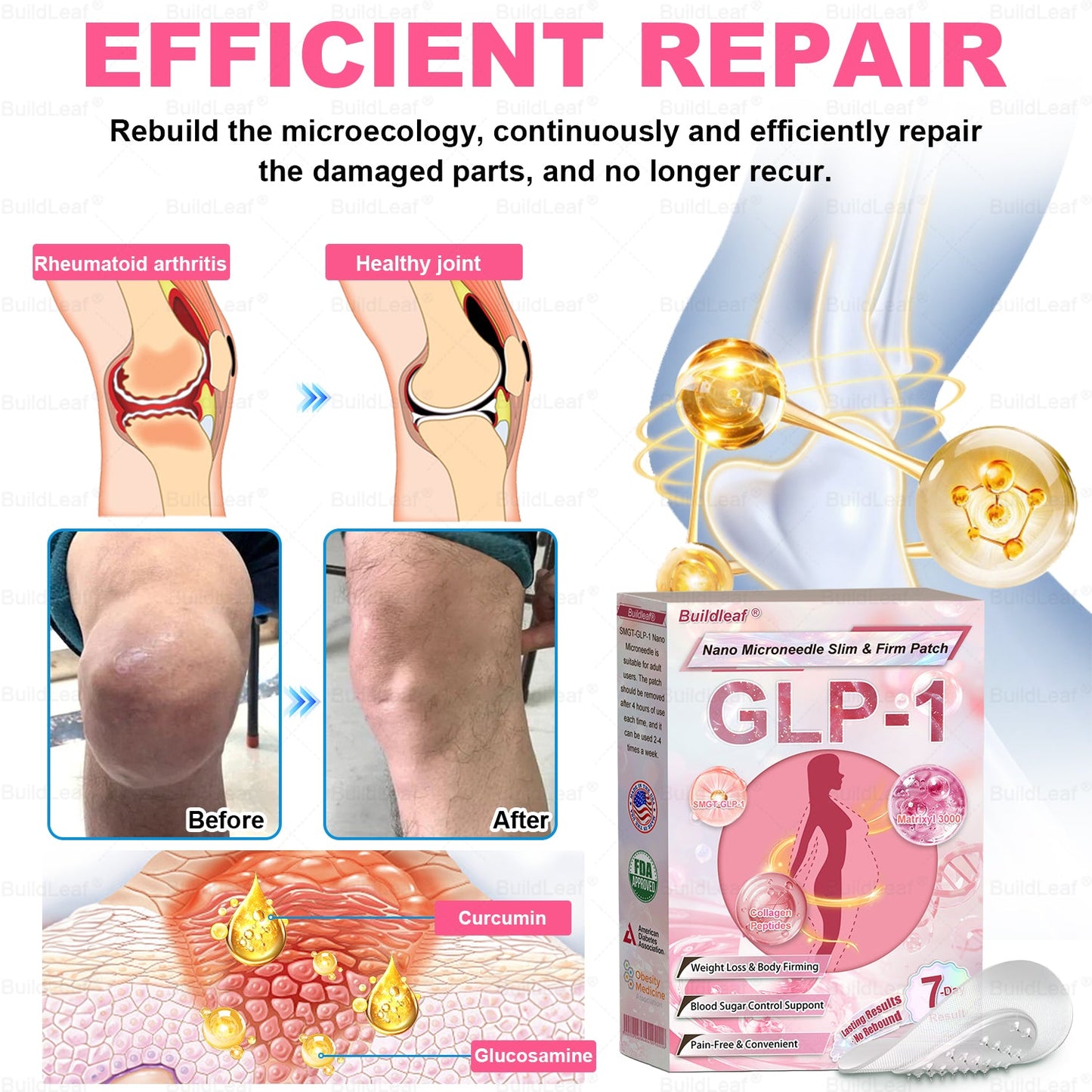 FDA Store | 𝐵uil𝗱𝐿ea𝐟® 𝐆𝐋𝐏-𝟏 Support 𝑁ano 𝑀icroneedle 𝑃atch with Collagen & Matrixyl 3000 丨Obesity,Cardiovascular Diseas, Diabetes, Sleep Apnea, Joint Problems and More