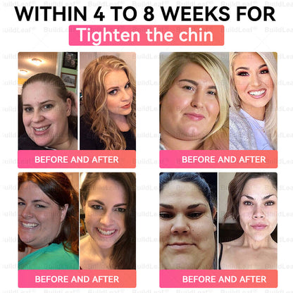 FDA Store | 𝐵uil𝗱𝐿ea𝐟® 𝐆𝐋𝐏-𝟏 Support 𝑁ano 𝑀icroneedle 𝑃atch with Collagen & Matrixyl 3000 丨Obesity,Cardiovascular Diseas, Diabetes, Sleep Apnea, Joint Problems and More