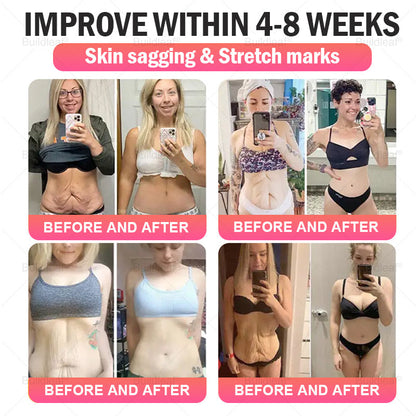 FDA Store | 𝐵uil𝗱𝐿ea𝐟® 𝐆𝐋𝐏-𝟏 Support 𝑁ano 𝑀icroneedle 𝑃atch with Collagen & Matrixyl 3000 丨Obesity,Cardiovascular Diseas, Diabetes, Sleep Apnea, Joint Problems and More