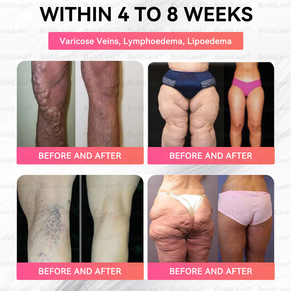 FDA Store | 𝐵uil𝗱𝐿ea𝐟® 𝐆𝐋𝐏-𝟏 Support 𝑁ano 𝑀icroneedle 𝑃atch with Collagen & Matrixyl 3000 丨Obesity,Cardiovascular Diseas, Diabetes, Sleep Apnea, Joint Problems and More